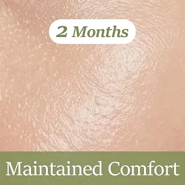 Skin after two months of consistent ChiroLife balm use